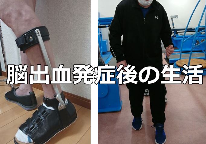 ②脳出血発症後の生活